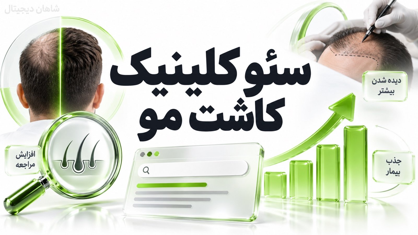 سئو کلینیک کاشت مو | جذب بیمار از گوگل تا نوبت